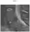 Fig. 12 - METHODS AND COMPOSITIONS TO FACILITATE REPAIR OF AVASCULAR TISSUE