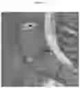 Fig. 13 - METHODS AND COMPOSITIONS TO FACILITATE REPAIR OF AVASCULAR TISSUE