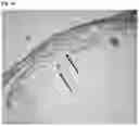 Fig. 02 - NASAL SEPTUM CARTILAGE COMPOSITIONS AND METHODS