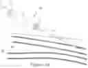 Fig. 02 - Systems and Methods for Percutaneous Intravascular Access and Guidewire Placement