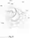 Fig. 06 - Circulation pump for vertically circulating water in bodies of water using consecutive expanding super air bubbles