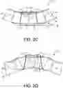 Fig. 08 - Block with curved engagement surfaces for maintaining even setback