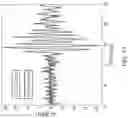 Fig. 06 - Ultrasound detection based on phase shift