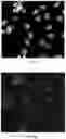 Fig. 09 - Polymer microfilters, devices comprising the same, methods of manufacturing the same, and uses thereof