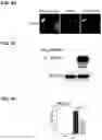 Fig. 09 - METHODS OF IDENTIFYING PARKIN-MEDIATED MITOPHAGY ACTIVATING AGENTS