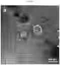 Fig. 06 - QUANTIFICATION, ISOLATION, AND CHARACTERIZATION OF EXOSOMES USING DROPLET-BASED AND WELL-BASED MICROFLUIDIC SYSTEMS