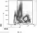 Fig. 08 - COMPOSITION FOR DIAGNOSING BONE METASTASIS OF CANCER AND METHOD FOR DIAGNOSING BONE METASTASIS OF CANCER USING SAME