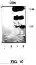 Fig. 07 - METHOD FOR DETECTING THE PRESENCE AND QUANTITY OF THE LRP8 RECEPTOR AND OF ITS PROTEOLYTIC FRAGMENTS, DETECTION KIT AND RELATED ANTIBODIES