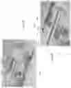 Fig. 09 - Integrated Fiber Bragg Grating accelerometer in a surgical instrument
