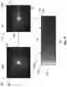 Fig. 02 - Systems and methods for quantifying light flares in images