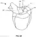 Fig. 06 - SYSTEM AND METHOD FOR PERFORMING VIRTUAL SURGERY