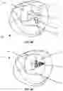 Fig. 07 - SYSTEM AND METHOD FOR PERFORMING VIRTUAL SURGERY