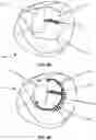 Fig. 08 - SYSTEM AND METHOD FOR PERFORMING VIRTUAL SURGERY