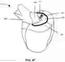 Fig. 09 - SYSTEM AND METHOD FOR PERFORMING VIRTUAL SURGERY