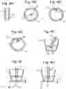 Fig. 07 - SYSTEM FOR HEATING AND FROTHING A BEVERAGE, A DEVICE FOR HEATING AND FROTHING A BEVERAGE SUITABLE FOR BEING USED IN SUCH A SYSTEM, A FROTH WAND SUITABLE FOR BEING USED IN SUCH A SYSTEM AND A METHOD OF PREPARING A BEVERAGE USING SUCH A SYSTEM