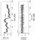 Fig. 31 - Apparatus, devices and methods for obtaining omnidirectional viewing by a catheter