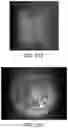 Fig. 48 - Apparatus, devices and methods for obtaining omnidirectional viewing by a catheter