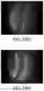 Fig. 62 - Apparatus, devices and methods for obtaining omnidirectional viewing by a catheter