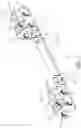 Fig. 02 - FLEXIBLE BONE FIXATION DEVICE