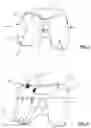 Fig. 02 - Systems and Methods for Selecting Artificial Femoral Components