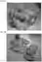 Fig. 02 - COMPOSITIONS AND METHODS FOR TREATING AND PREVENTING ADHESIONS AND ILUES
