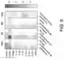 Fig. 11 - B CELL IMMUNOTHERAPY