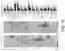 Fig. 17 - B CELL IMMUNOTHERAPY