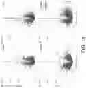 Fig. 18 - B CELL IMMUNOTHERAPY