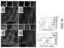 Fig. 23 - B CELL IMMUNOTHERAPY