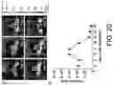 Fig. 24 - B CELL IMMUNOTHERAPY