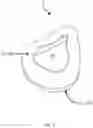 Fig. 02 - MASK BEAD WITH TUBE FEEDTHROUGH