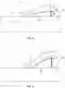 Fig. 06 - Catheter Assembly With Angle Changing and Related Methods