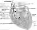 Fig. 01 - Methods for operating a dual-chamber pacemaker to avoid triggering atrial fibrillation and perpetuation of repetitive ventriculo-atrial synchrony