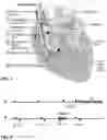 Fig. 02 - Methods for operating a dual-chamber pacemaker to avoid triggering atrial fibrillation and perpetuation of repetitive ventriculo-atrial synchrony