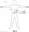 Fig. 03 - Adjustment of analgesic stimulation parameters based on trust dynamic measurements