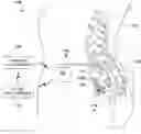 Fig. 01 - Autotitration of therapy using detected electrical activity