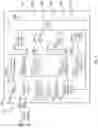 Fig. 03 - Method and device for controlling cardiac resynchronization therapy based on heart sounds