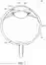 Fig. 02 - OPHTHALMIC ILLUMINATION DEVICE
