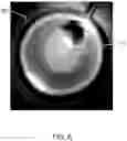 Fig. 09 - OPHTHALMIC ILLUMINATION DEVICE