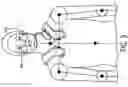 Fig. 10 - Wearable, maskless respiratory isolation device