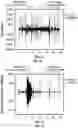 Fig. 16 - SYSTEMS AND METHODS FOR AUTOMATED RESPIRATOR