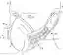 Fig. 01 - Respiratory face mask for improved communications