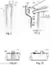 Fig. 02 - Door frame exercise system