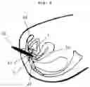 Fig. 05 - Device for exercising the pelvic floor muscles