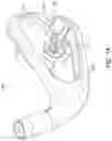 Fig. 12 - GOLF CLUB HAVING A DAMPING ELEMENT FOR BALL SPEED CONTROL