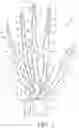 Fig. 02 - Glove with expandable finger stall