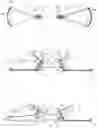 Fig. 06 - SET OF COUPLING ASSEMBLIES FOR A BOARD FOR BOARD SPORTS