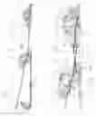 Fig. 17 - SET OF COUPLING ASSEMBLIES FOR A BOARD FOR BOARD SPORTS