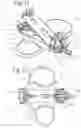 Fig. 30 - SET OF COUPLING ASSEMBLIES FOR A BOARD FOR BOARD SPORTS