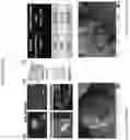 Fig. 03 - METHODS FOR CONVERTING COLLOIDAL SYSTEMS TO RESUSPENDABLE/REDISPERSABLE POWDERS THAT PRESERVE THE ORIGINAL PROPERTIES OF THE COLLOIDS